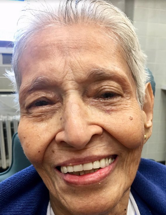 prevent broken dentures