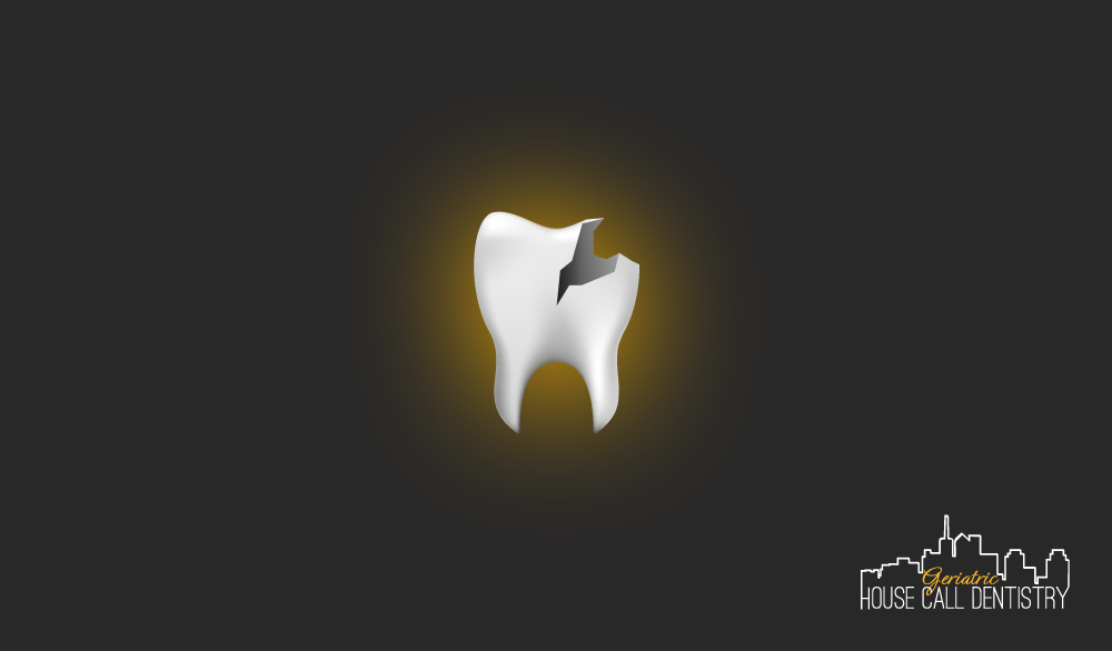 What to do if you are elderly, have a broken tooth and can’t get to the dentist because of physical or cognitive limitations…