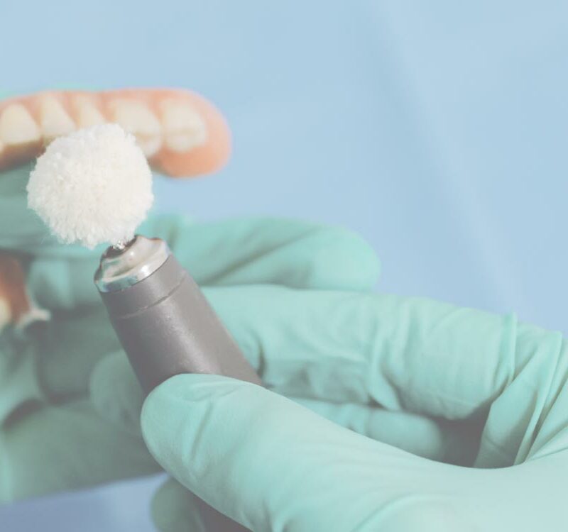 Replacing lost dentures and duplicating dentures