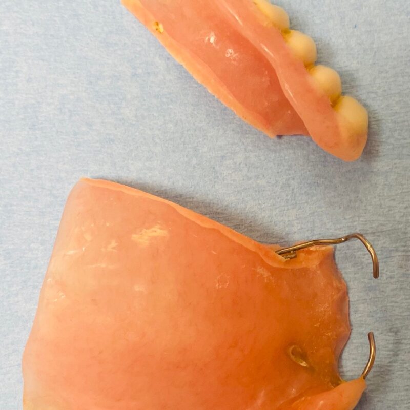 Newest Dentures Available