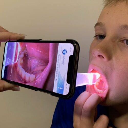Wobbly Tooth